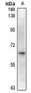 Anti-Alpha-2B Adrenergic Receptor Antibody